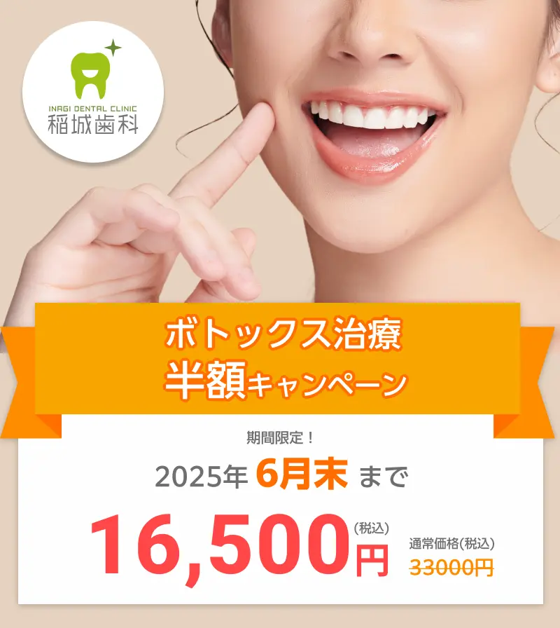 稲城歯科ボトックス半額キャンペーン6月末まで