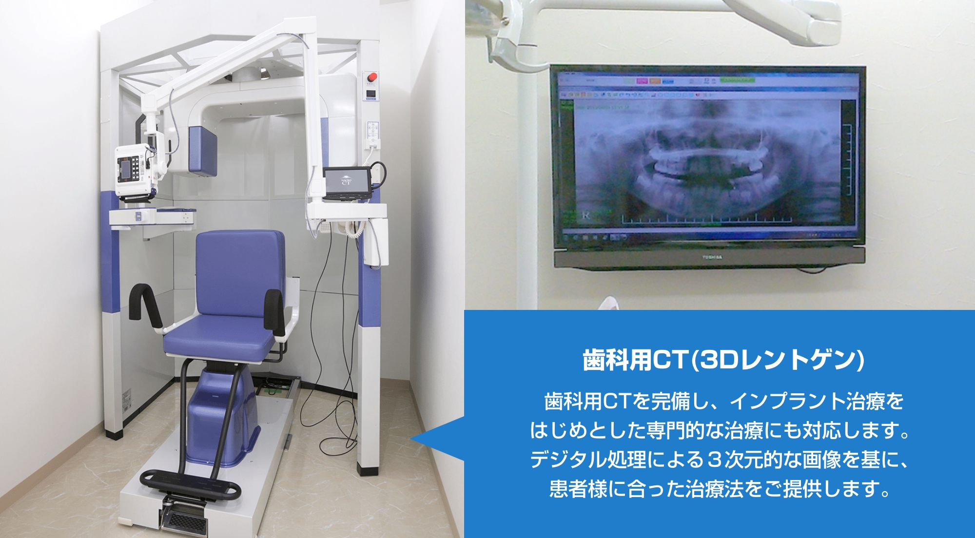 歯科用CT(3Dレントゲン)｜歯科用CTを完備し、インプラント治療をはじめとした専門的な治療にも対応します。<br>デジタル処理による３次元的な画像を基に、患者様に合った治療法をご提供します。